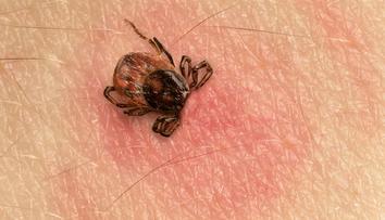 Někteří pacienti, kterým byla zjištěna borelióza, berou antibiotika zbytečně