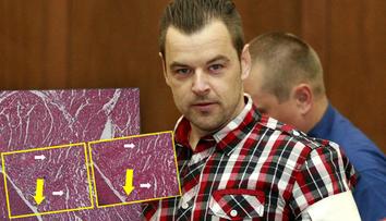 Nemocnice zničila klíčové důkazy v případu Kramný! Vysvětlila proč