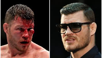 UFC šampion zápasil pět let skoro slepý! Nakonec raději ukončil kariéru
