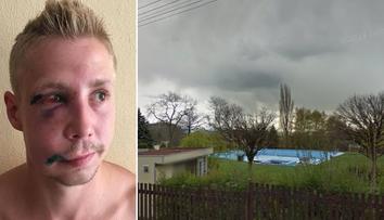 Je to jinak, tvrdí svědkyně o bitce v Dubí: Není to hrdina, praštil ženu