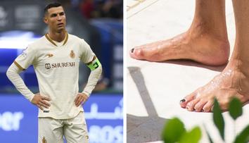 Proč si Ronaldo lakuje nehty na černo? Důvod je praktický