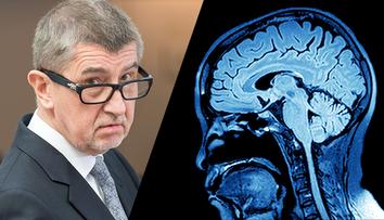 Nemoci Babišových dětí přináší myšlenky na smrt, říká psychiatr