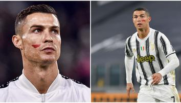Tajemství červené skvrny na tváři Ronalda? Je to kampaň!