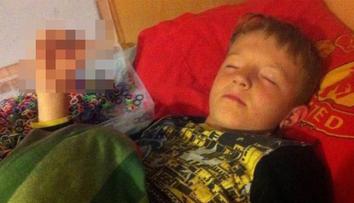 Gumičková závislost: Školák (8) málem přišel o prsty! Foto uvnitř