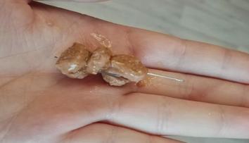 Na východě Čech řádí travič psů, návnady hází lidem přímo do zahrad!
