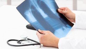 Průlom v boji s rakovinou plic? Vědci chystají preventivní vakcínu
