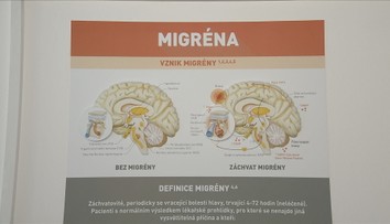 Česko se potýká s výpadkem léků na migrénu. Alternativa se značně prodraží