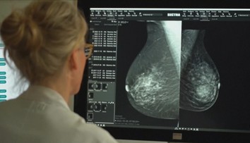 Mamograf snižuje úmrtnost na rakovinu o třetinu. Některé ženy ale vyšetření ignorují