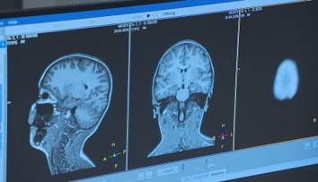 Magnetická rezonance bez strachu. Hra pomáhá dětem zvládnout vyšetření