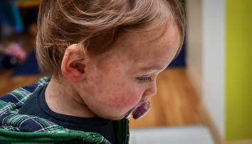 Evropou se šíří silně infekční nemoc. Nakazit vás může i člověk, který už v místnosti není