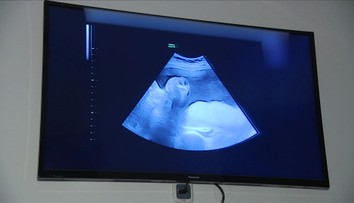 Přes milion žen zanedbává kontroly u gynekologa. Podceňují je hlavně starší ročníky
