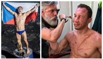 Děsivé šrámy a modřiny. Šampion ve skocích do vody vystrašil fanoušky