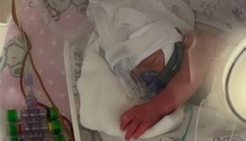 V Krakově se narodila paterčata. Doma na ně čeká sedm sourozenců