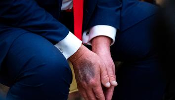 Záběry Trumpa vyvolaly divoké spekulace o jeho zdraví. Bílý dům má bizarní vysvětlení