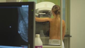 Češi nechodí na prevence. Pravidelně na onkologii zamíří jen třetina