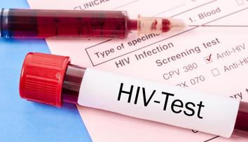V části Evropy roste počet případů HIV. Výskyt viru eviduje i Česko