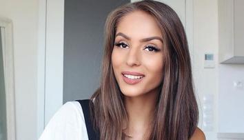 Youtuberka Třešňáková ukázala děsivou fotku spáleného těla