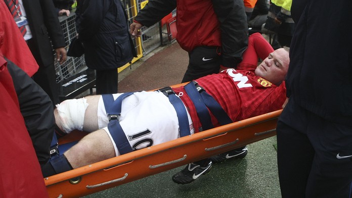 Rooney mohl vykrvácet! Od neštěstí ho zachránil jeden milimetr