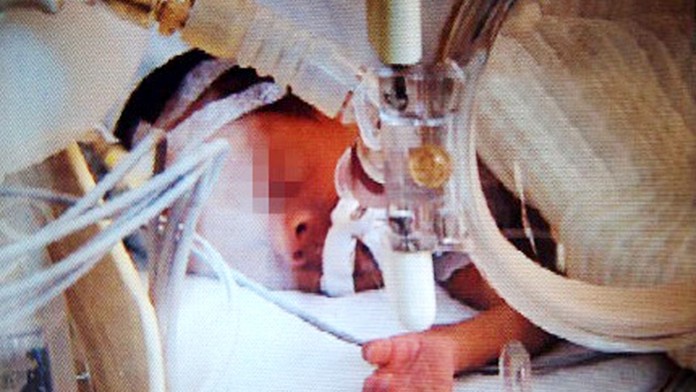 Dítě měsíc po porodu prohlásili za mrtvé. Před kremací přišel šok