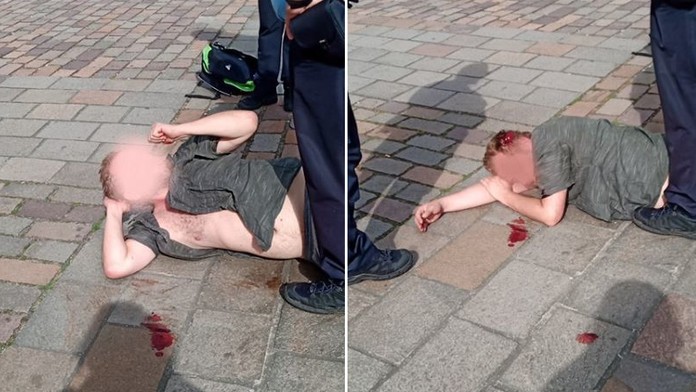 Polonahý agresor útočil na strážnici, skončil se zkrvavenou hlavou!