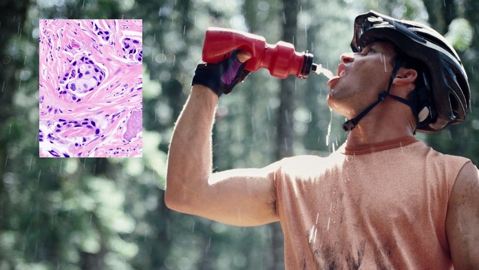 Pozor na polykarbonátové láhve! Může v nich být smrtící bisfenol, který vyvolává RAKOVINU