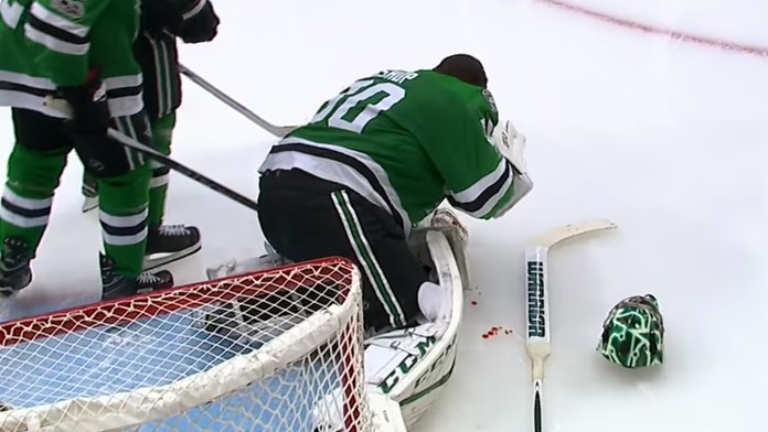 Šílená zranění z posledních hodin v NHL: FOTO jen pro silné povahy!