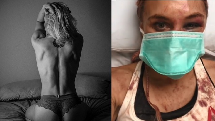 Drsná proměna: Kráska z UFC byla po zápase k nepoznání!