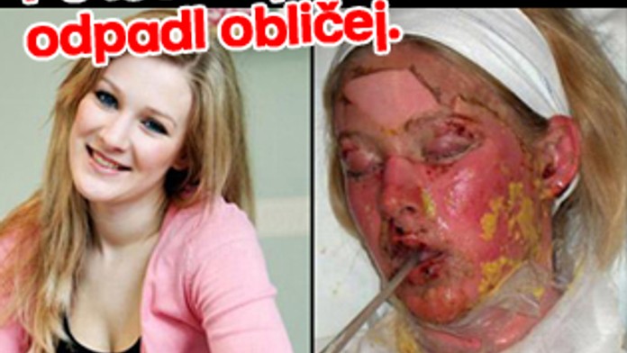 Po lécích jí zčernal a odpadl obličej. Už ho má zpět