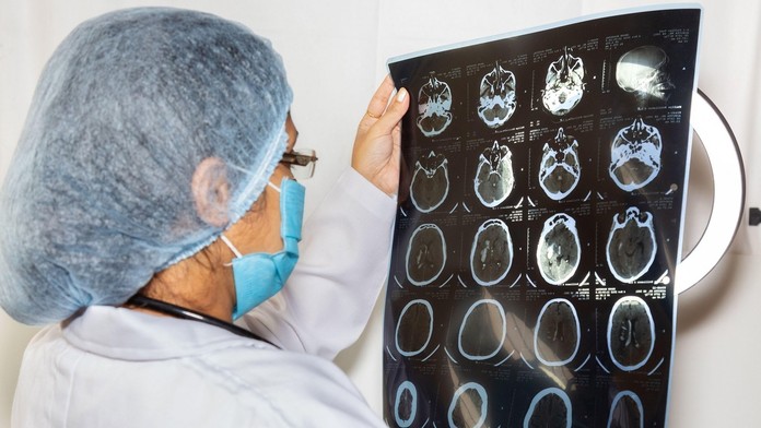 Lidé často podceňují příznaky zákeřné nemoci. Lékaři před ní důrazně varují