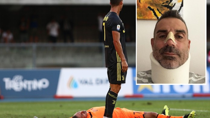 První zářez CR7 v Serii A: Gólman v bezvědomí se zlomeným nosem!