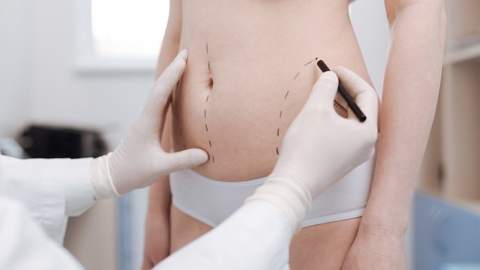 Sen o dokonalých křivkách: Vše o liposukci a tvarování těla