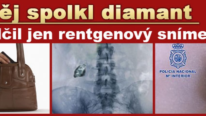 Zloděj spolkl kradený diamant. Usvědčil jej rentgenový snímek