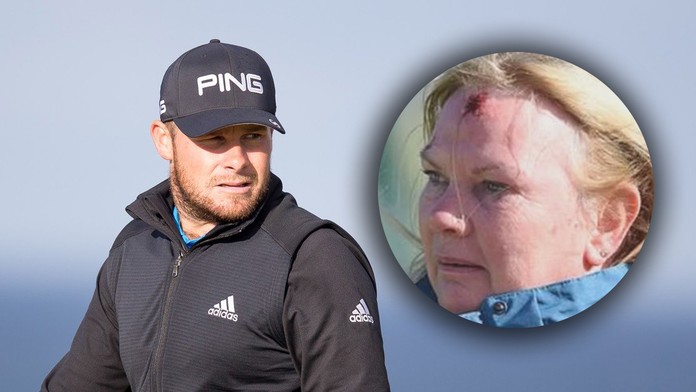Další krvavé zranění fanynky na golfu: Po míčku díra v čele! FOTO