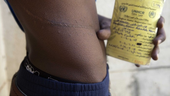 Do Evropy za ledvinu! Migranti za cestu přes moře platí orgány