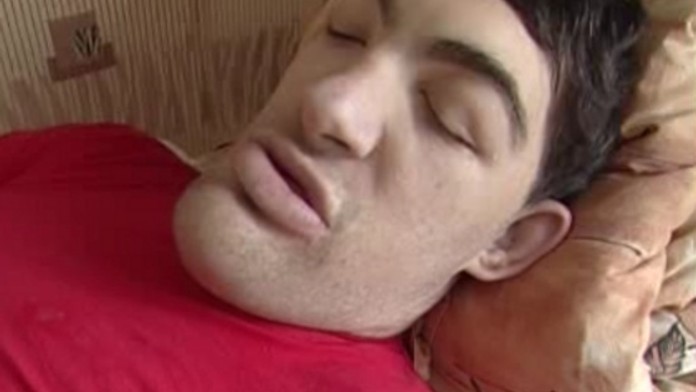 Lékaři operovali největšího Čecha