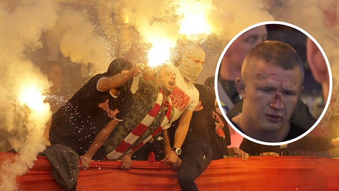 Brutální potyčka před finále LM: Angličtí fanoušci skončili v krvi!