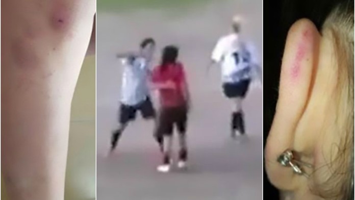 Za faul se pomstila tvrdým loktem! Fotbalistka zůstala ležet VIDEO