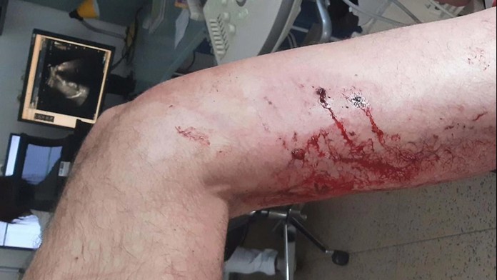 Agresor na muže bezdůvodně poštval psa. Navíc mu přidal kopance