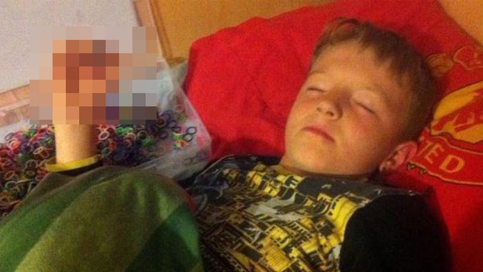 Gumičková závislost: Školák (8) málem přišel o prsty! Foto uvnitř