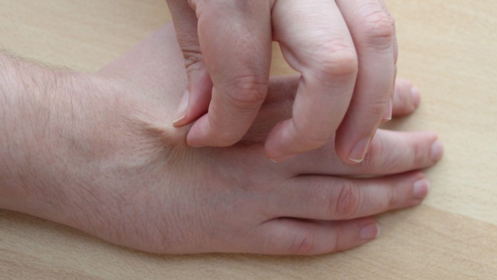 Lékař popisuje snadný test s kůží. Za pár vteřin může odhalit dehydrataci