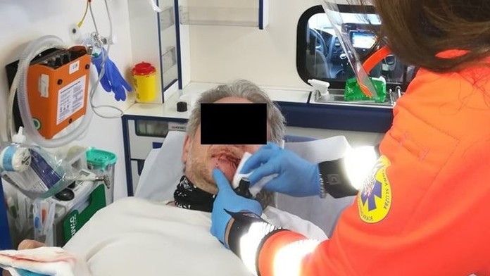 Muž se sehnul ke své fence, chtěl jí dát pusu. Skončil s plastikou obličeje