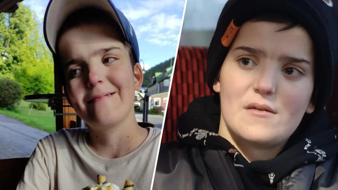 Vážně nemocná Hanička se chce opět šťastně usmívat. Nadějí pro ni je operace zubů