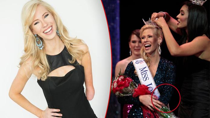 Zázrak v americké MISS: Vyhrála kráska (23) bez ruky!