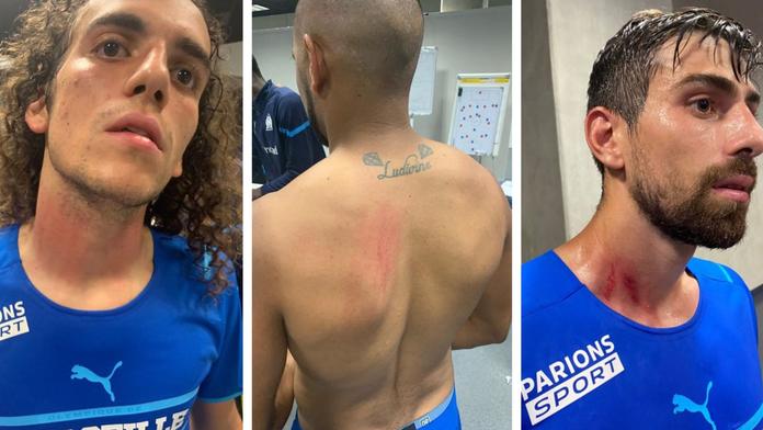 Hráči Marseille po konfliktu s fanoušky: Rány na krku i zádech