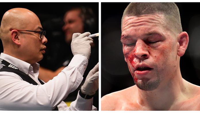 Doktor z UFC se bojí o svůj život! Od diváků mu chodí výhružky smrtí