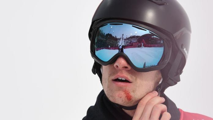 Hvězdě snowboardingu se otočil život. Medaili z OH střídá rakovina!