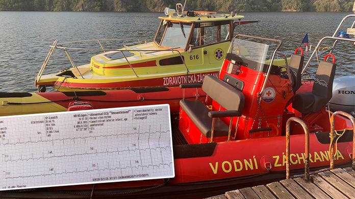 Zákrok ženy zachránil muži život! Konala správně, řekl záchranář