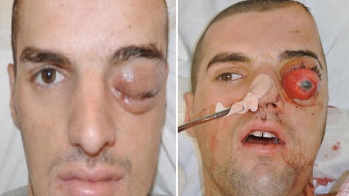 Hrůzné foto: Hádejte, proč si tento muž prostřelil hlavu a jak dopadl