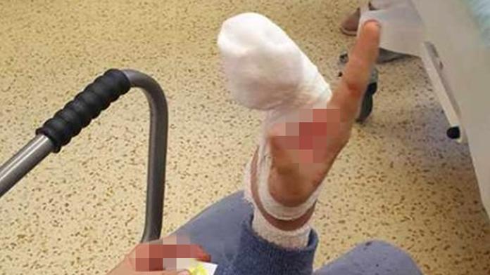 Malý chlapec si na koloběžce zranil ruku, utržený prst našli v parku