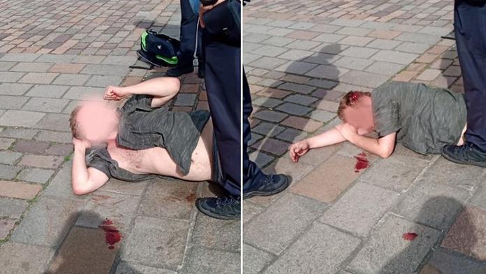 Polonahý agresor útočil na strážnici, skončil se zkrvavenou hlavou!